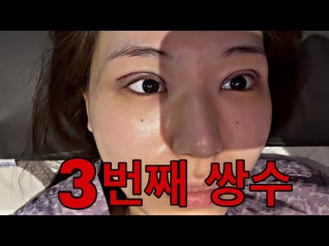 망한 소세지쌍수 재재수술 브이로그