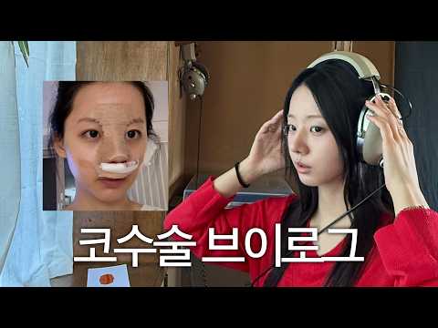 코수술 브이로그👃🏻 인생 첫 성형수술..!!!!