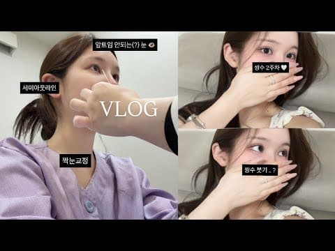 VLOG 쌍수 2주차..(솔직히 댕 잘됌;;)ft세미아웃•장원영눈(죄송..)자연유착•짝눈교정•쌍수후기•앞트임•제자리트임•매몰•눈수술•성형후기•직장인•일상•직장인브이로그 